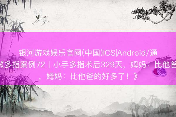 银河游戏娱乐官网(中国)IOS|Android/通用APP下载 《多指案例72丨小手多指术后329天，姆妈：比他爸的好多了！》