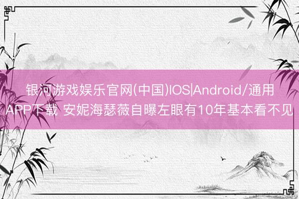 银河游戏娱乐官网(中国)IOS|Android/通用APP下载 安妮海瑟薇自曝左眼有10年基本看不见